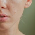 Wie beeinflussen Hormone die Hautgesundheit? Ein umfassender Ratgeber für Frauen und Männer in Deutschland
