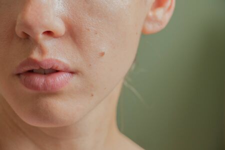 Wie beeinflussen Hormone die Hautgesundheit? Ein umfassender Ratgeber für Frauen und Männer in Deutschland