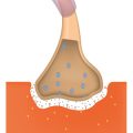 Makellose Haut ab 50: Tipps gegen Pigmentflecken und Altersflecken