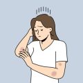 Naturkosmetik bei Hautproblemen: Sanfte Hilfe bei Akne, Rosazea und Co.